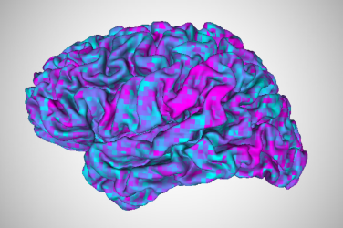 aphasia